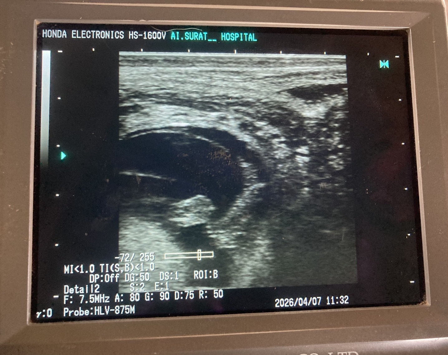 S 74153993