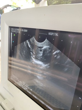 S 22446093 0