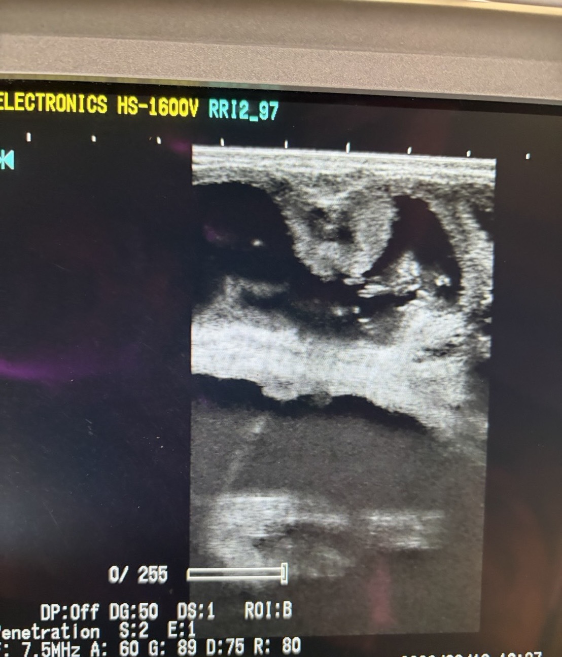 S 3842089 0